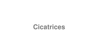 Cicatrices