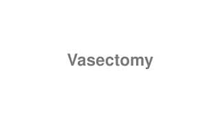 Vasectomy