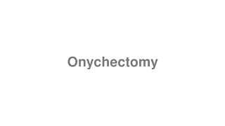 Onychectomy