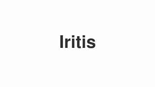 Iritis