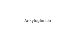 Ankyloglossia