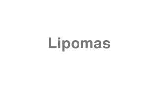 Lipomas