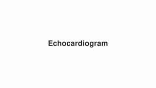 Echocardiogram