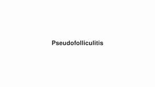 Pseudofolliculitis
