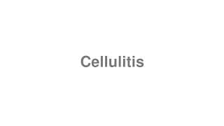 Cellulitis