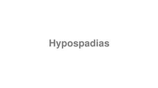 Hypospadias