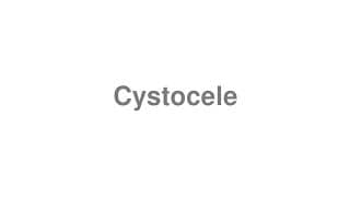 Cystocele