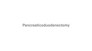 Pancreaticoduodenectomy