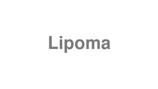 Lipoma