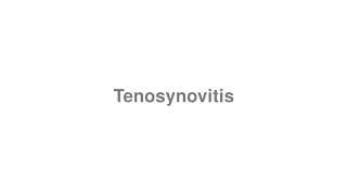 Tenosynovitis
