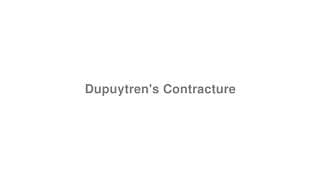 Dupuytren's Contracture