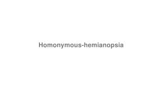 Homonymous-hemianopsia