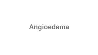 Angioedema