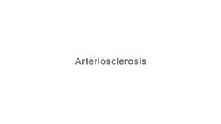 Arteriosclerosis